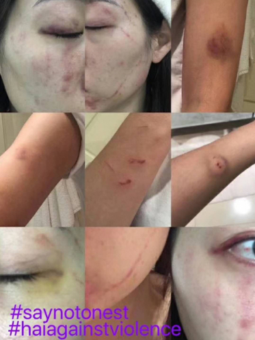 violence-shanghai-lgbt-1