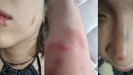 Barrio Bellavista lesbophobia