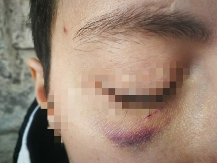 Barivecchia lesbophobia