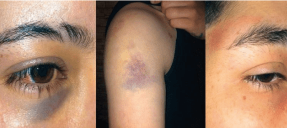 Chile Soldier abuse of lesbians